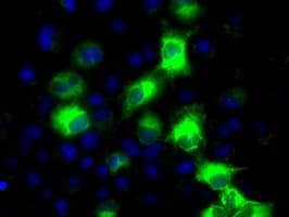 CYP2E1 Antibody (clone OTI5B9)