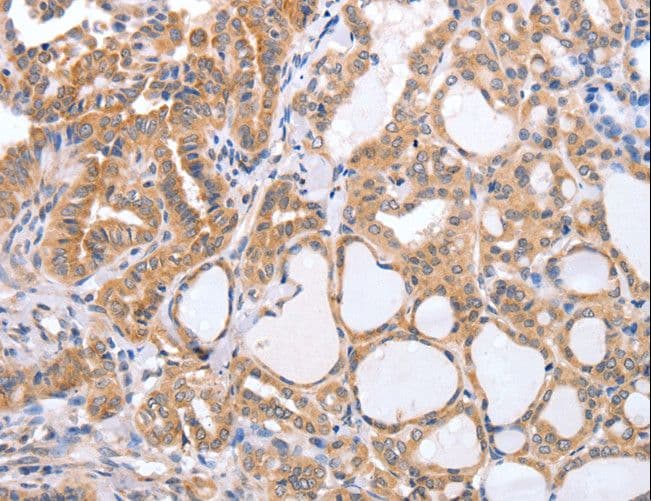 Polyclonal Rabbit anti-Human TGFA / TGF Alpha Antibody (IHC)