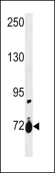 Polyclonal Rabbit anti-Human SLC28A1 Antibody (aa381-409, WB)