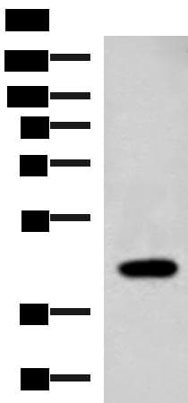 ADH2 / ADH1B Antibody