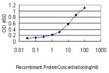 IHC-plus™ ORM1 / Orosomucoid Antibody (clone 2F9-1F10)