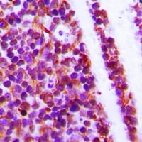 Polyclonal Rabbit anti-Human WIPF1 / WIP Antibody (C-Terminus, IHC, WB)