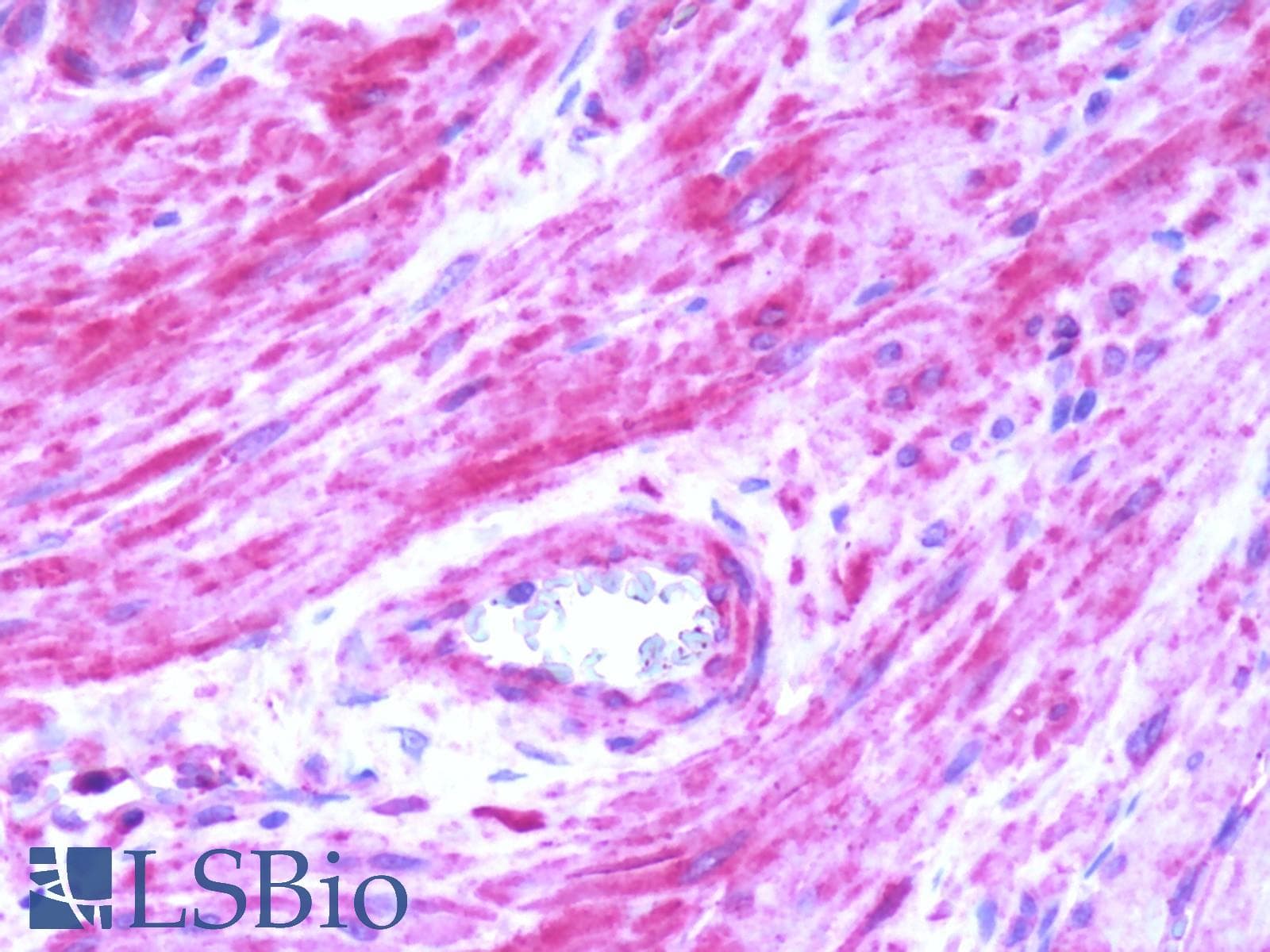 PathPlus™ Polyclonal Rabbit anti-Human BDKRB2/Bradykinin B2 Receptor Antibody (C-Terminus, IHC)