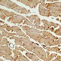 Polyclonal Rabbit anti-Human TUBB3 / Tubulin Beta 3 Antibody (IHC, WB)