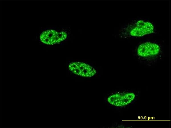 Monoclonal Mouse anti-Human NFKB1 / NF-Kappa-B Antibody (clone 4A11, IHC, IF, WB)