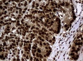 PCNA Antibody (clone OTI6A10)