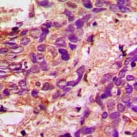 ACO1 / Aconitase Antibody (N-Terminus)