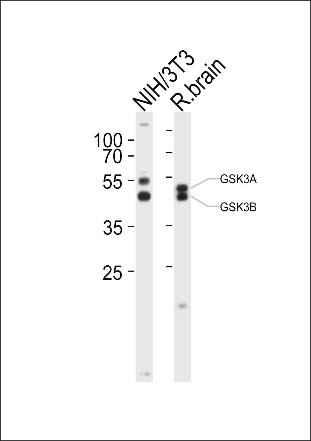 GSK3A / GSK3 Alpha Antibody (aa348-382)