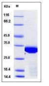Human BCL6 Protein (Recombinant TRX-His, N-terminus)