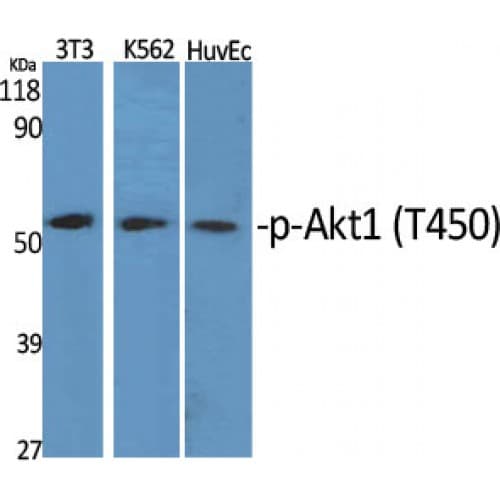 Polyclonal Rabbit anti-Human AKT1 Antibody (390-470 aa, IHC, WB)