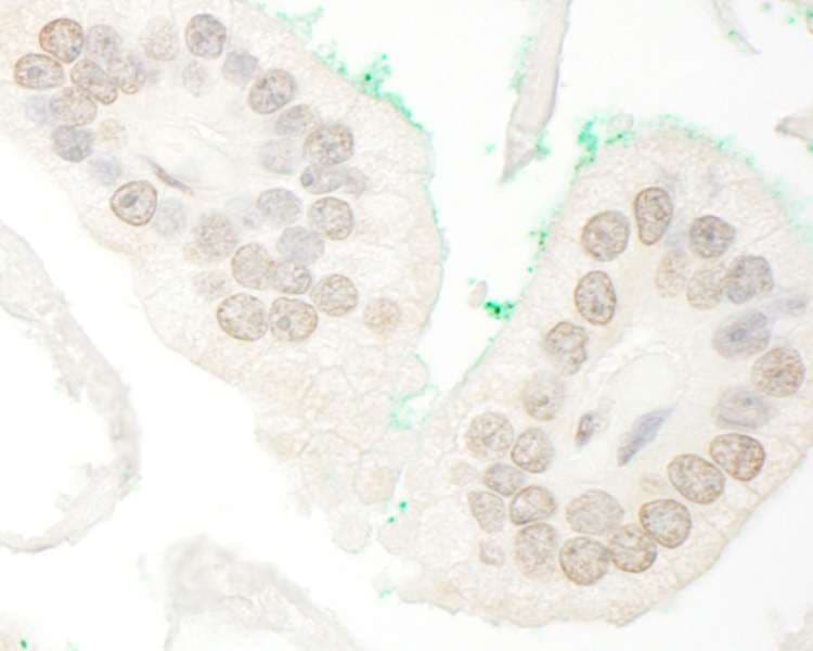 ARA70 / NCOA4 Antibody (aa500-550)