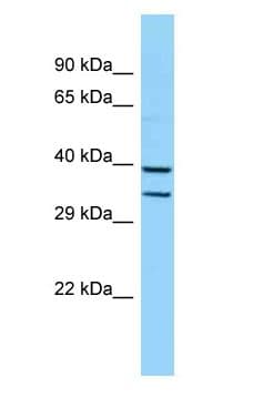 HOXB5 Antibody (aa121-170)