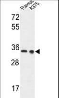 LDHA / LDH1 Antibody (aa154-182)