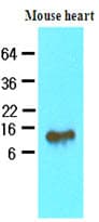 FABP4 / AP2 Antibody (aa1-132, clone 3F4)