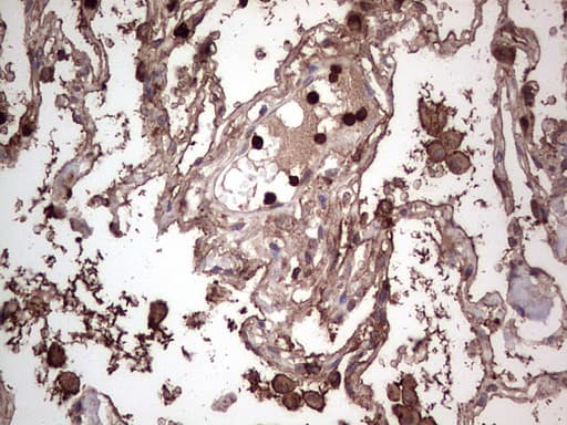 PKM2 Antibody (clone 12B9)
