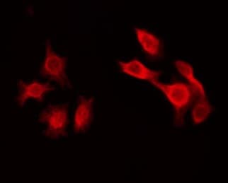 SHD Antibody