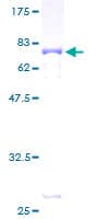 Human HOMER1 / Homer 1 Protein (Recombinant GST)