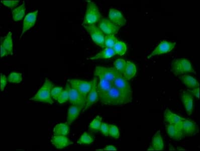 ACTN3 Antibody