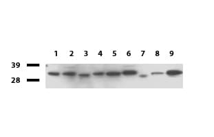 Monoclonal Mouse anti-Human GEMIN8 Antibody (clone UMAB185, IHC, WB)