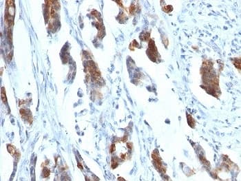 MUC5AC Antibody (clone 58M1)