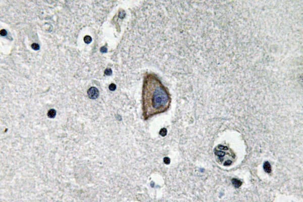 CD3E Antibody (aa22-71)