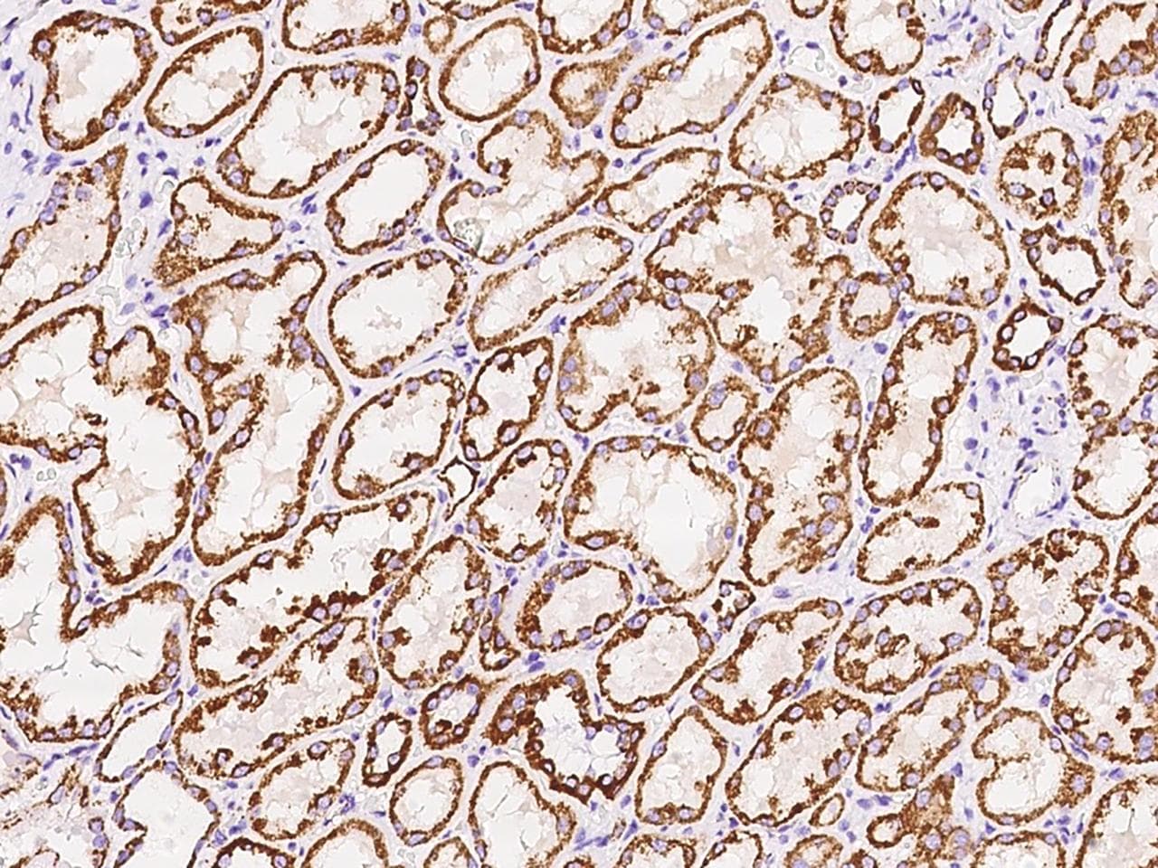 Polyclonal Rabbit anti-Human NDUFB5 Antibody (IHC, IF)