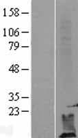 DPM2 Protein (Over-Expression Lysate Myc-DDK (Flag))