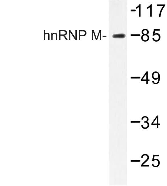 Polyclonal Rabbit anti-Human HNRPM / HNRNPM Antibody (Pro43, IHC, IF, WB)