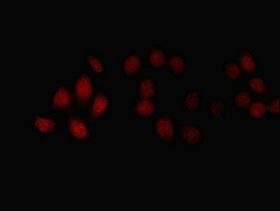 Polyclonal Rabbit anti-Human FBXL18 Antibody (WB)