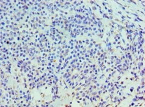 HYAL3 Antibody (aa198-417)
