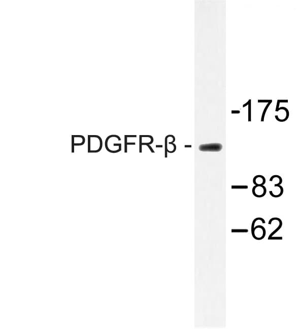 PDGFRB / PDGFR Beta Antibody (Gly1017)