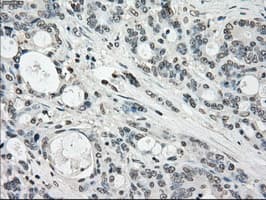 Monoclonal Mouse anti-Human CYPOR / POR Antibody (clone OTI3F10, IHC, IF, WB)