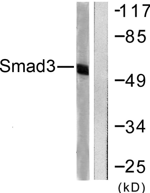SMAD3 Antibody (aa376-425)