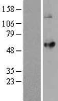 LPCAT2 Protein (Over-Expression Lysate Myc-DDK (Flag))