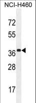 LEREPO4 / ZC3H15 Antibody (aa367-395)