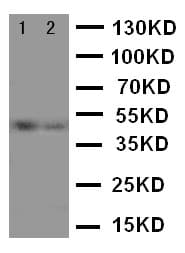 Vitamin D Receptor / VDR Antibody (aa389-404)