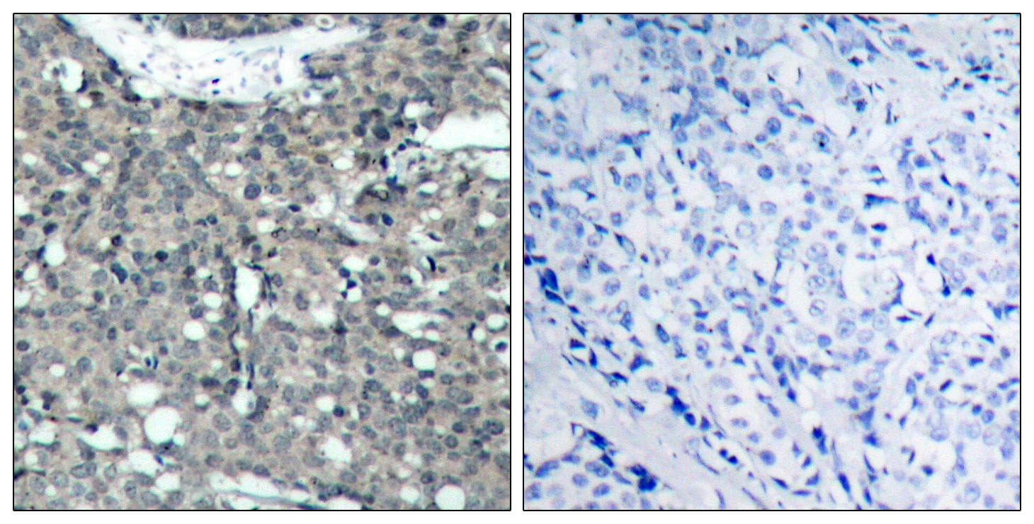 Polyclonal Rabbit anti-Human PXN / Paxillin Antibody (p118, IHC, WB)