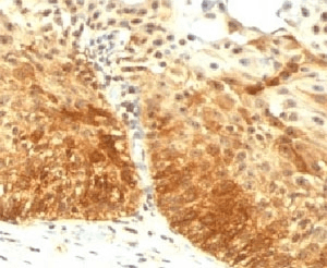 Monoclonal Mouse anti-Human KRT14 / CK14 / Cytokeratin 14 Antibody (clone LL002, Ready-to-Use, C-Terminus, IHC, IF, WB)
