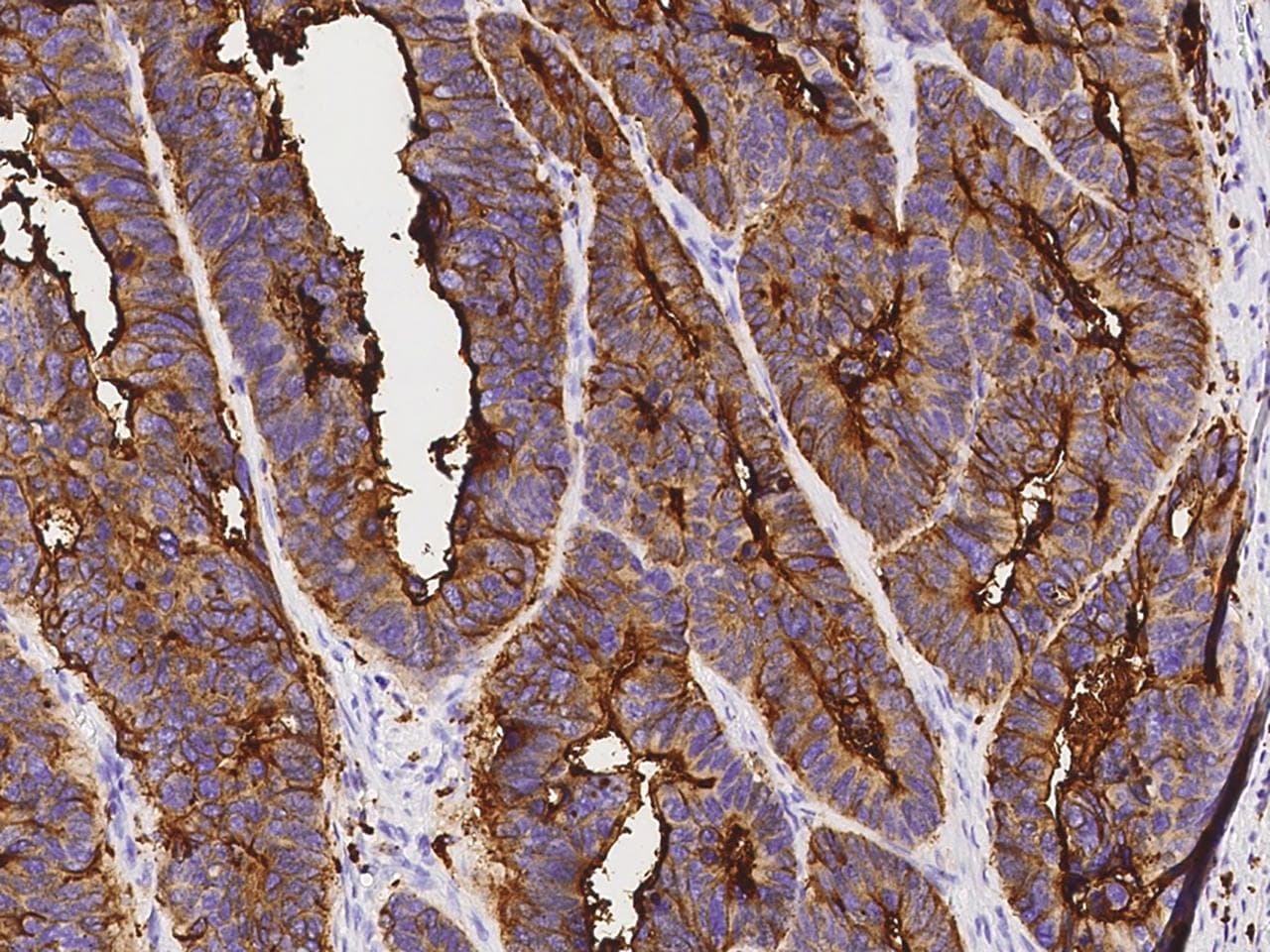 Polyclonal Rabbit anti-Human CD66d / CEACAM3 Antibody (Preservative Free, IHC)
