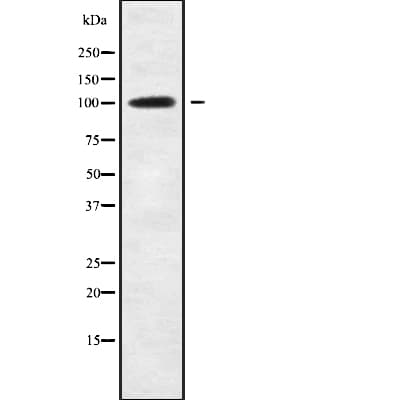 ETAA1 Antibody