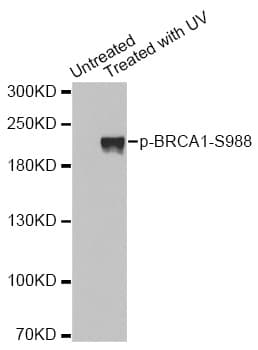 BRCA1 Antibody (phospho-Ser988)