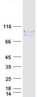 Human LRRN1 Protein (Recombinant Myc-DDK (Flag))