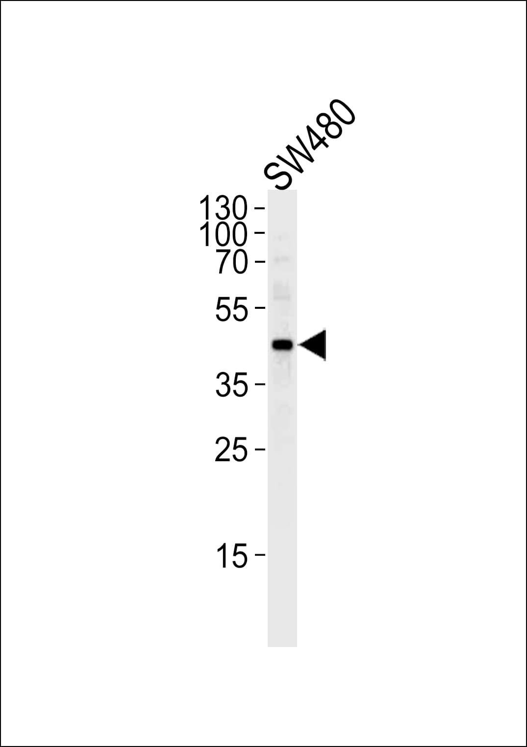 Polyclonal Rabbit anti-Human DNAJB11 Antibody (aa63-92, IHC, WB)