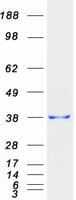 Human SSR1 Protein (Recombinant Myc-DDK (Flag))