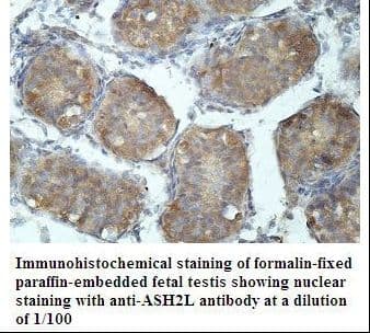ASH2L / ASH2 Antibody (aa200-380)
