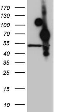 Monoclonal Mouse anti-Human HOXA3 Antibody (clone OTI8C5, aa40-276, WB)