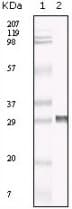 TIMP3 Antibody