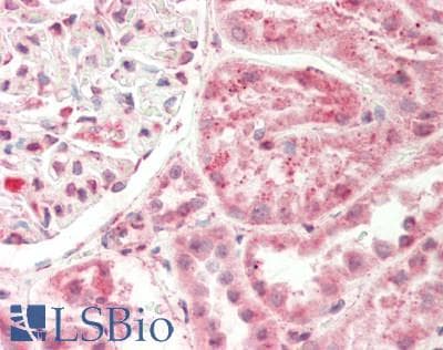 Polyclonal Rabbit anti-Human DAP3 Antibody (C-Terminus, IHC, WB)