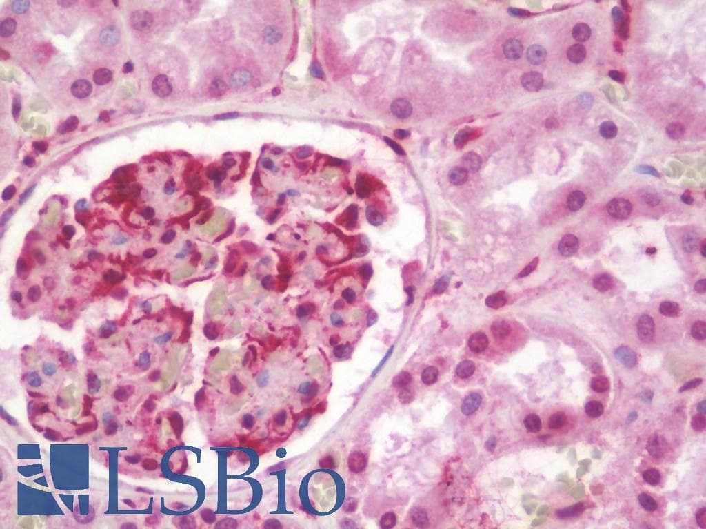 IHC-plus™ Polyclonal Rabbit anti-Human EIF2AK3 / PERK Antibody (aa73-102, IHC, WB)