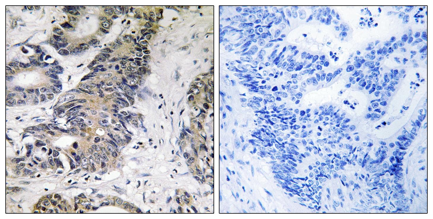 EIF4EBP1 / 4EBP1 Antibody